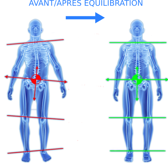 Mauvaise Posture